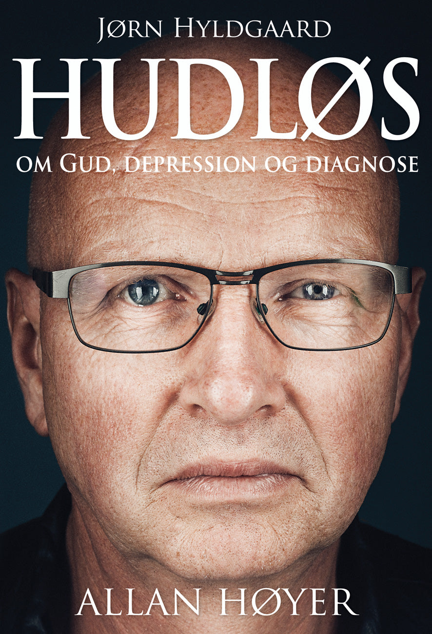 Hudløs